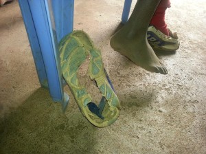 The school shoes on the child we are concerned about.